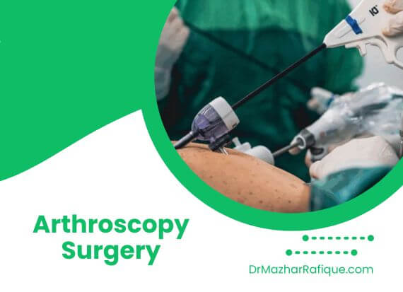Arthroscopy surgery in Lahore performed by Dr. Mazhar Rafique using minimally invasive technique