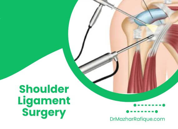 Shoulder ligament surgery performed by Dr. Mazhar Rafique in Lahore